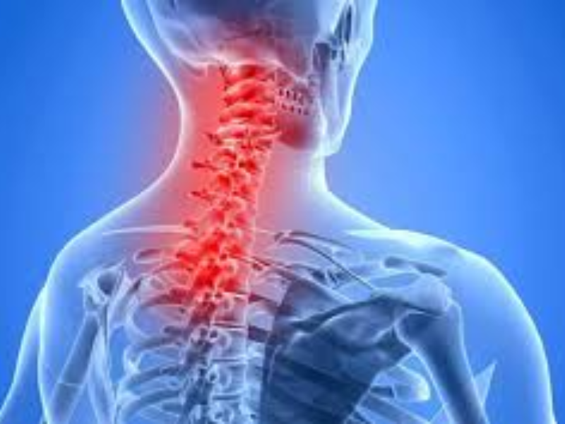 Neck Pain