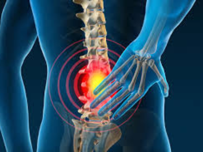 Back Pain